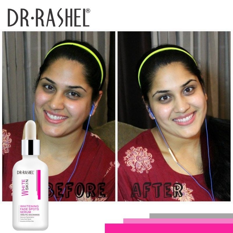 Dr-Rashel Whitening Fade Spots Serum