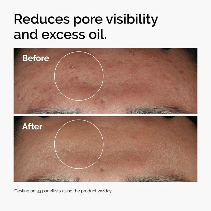 The Ordinary Niacinamide 10% + Zinc 1% ( with batch code )